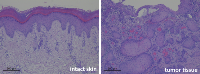 Comparison of intact skin cells versus skin tumour cells