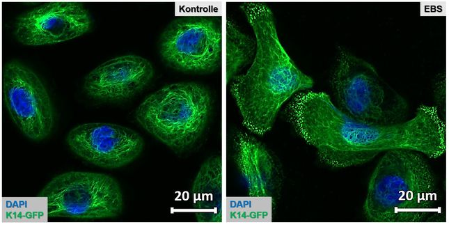 Healthy and mutated skin cells