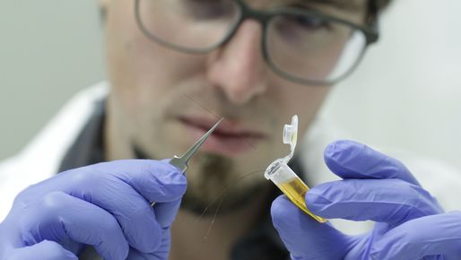 Forscher extrahiert im Labor Hautzellen aus Haarwurzeln