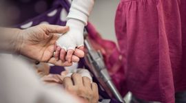 Hand of a child with Epidermolysis Bullosa 