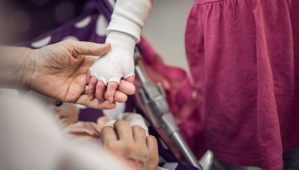 Hand of a child with Epidermolysis Bullosa 